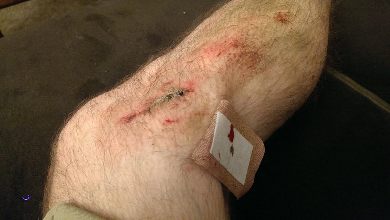 Illustration for article titled Bike crash aftermath pics, blood warning